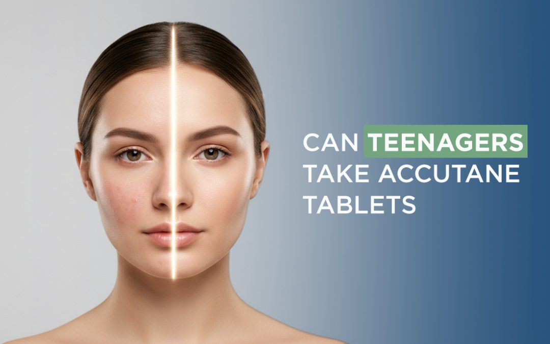 Can Teenagers Take Accutane Tablets?