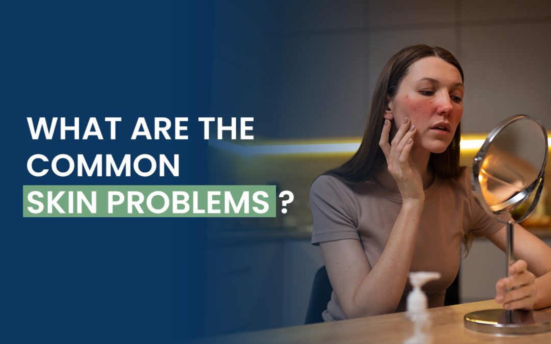 What are the Common Skin Problems?