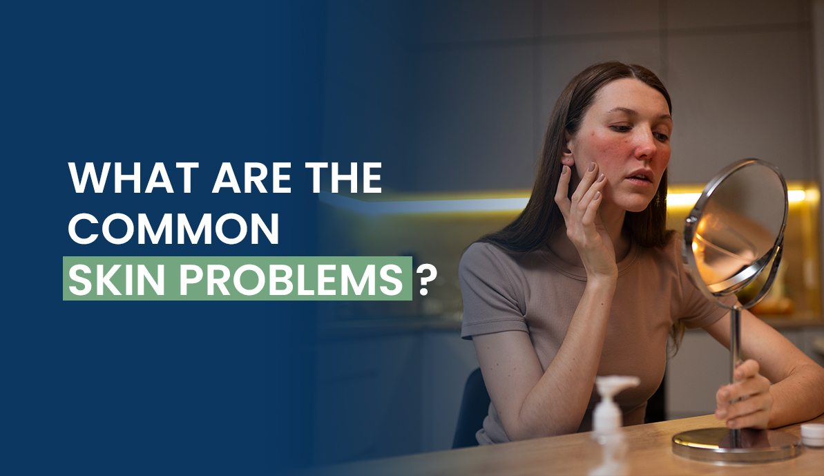 Common Skin Problems