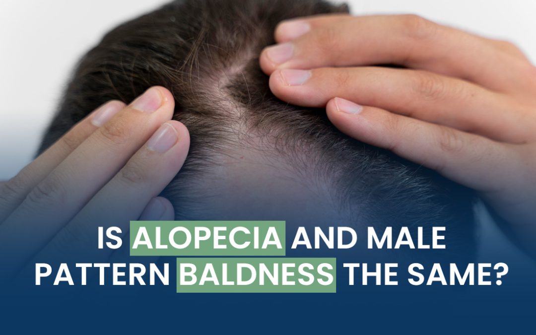 Is Alopecia and Male Pattern Baldness the Same?