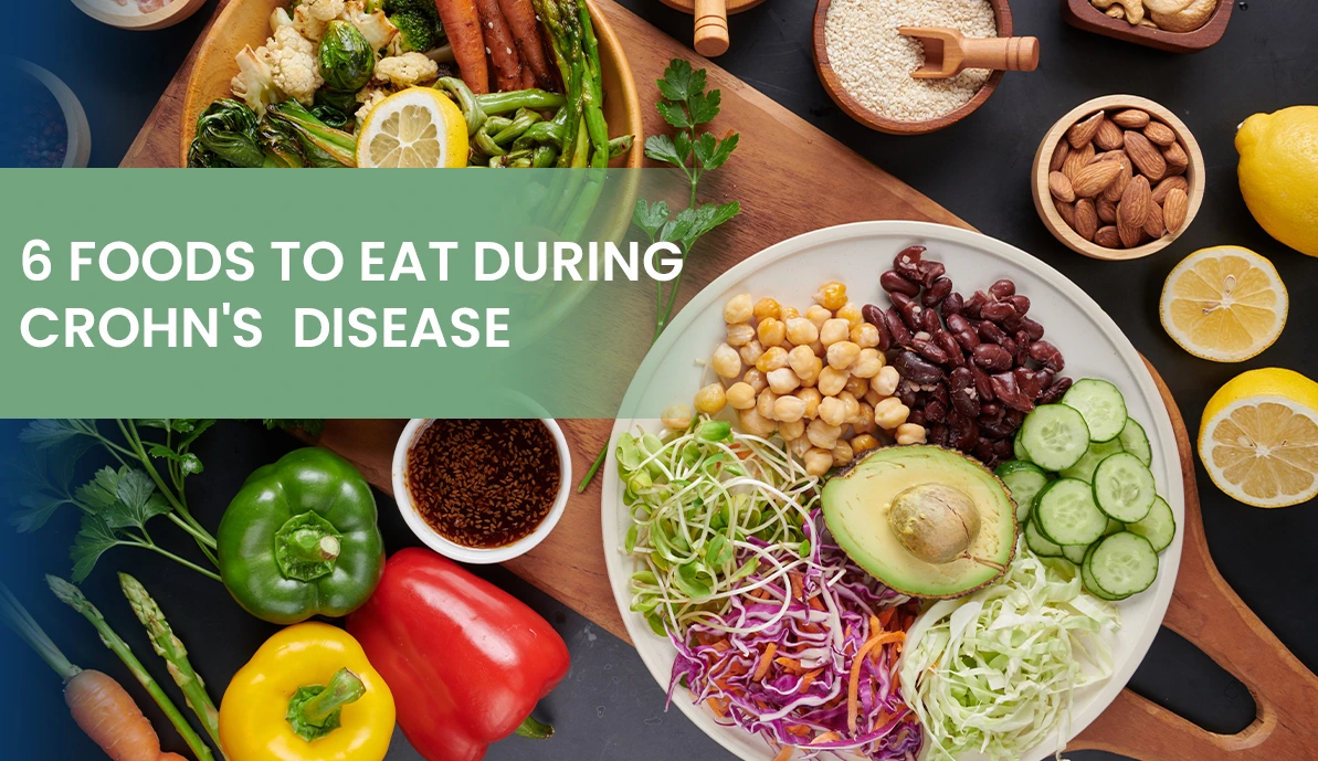 6 Foods to Eat During Crohn’s Disease