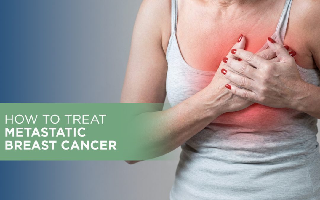 How to Treat Metastatic Breast Cancer?