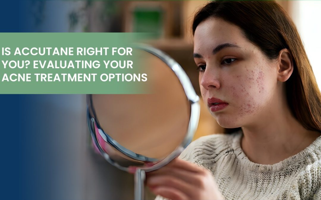 Is Accutane Right for You? Evaluating Your Acne Treatment Options