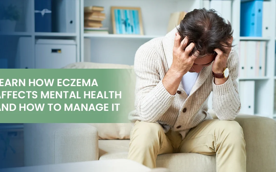 Learn How Eczema Affects Mental Health and How To Manage It