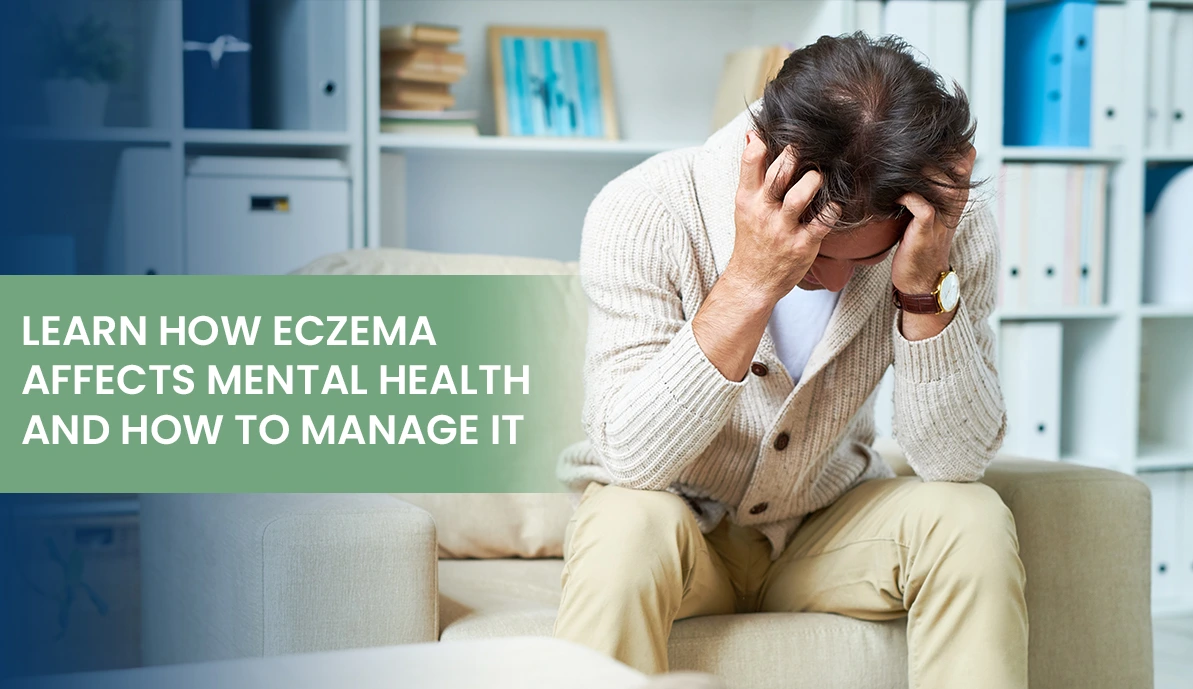 Learn How Eczema Affects Mental Health and How To Manage It