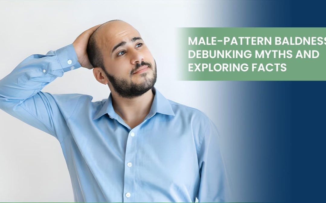 Male-Pattern Baldness: Debunking Myths and Exploring Facts