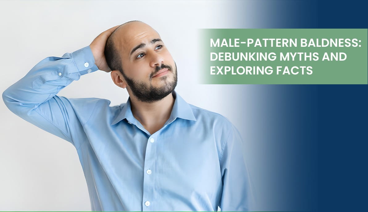 Male pattern baldness facts guide