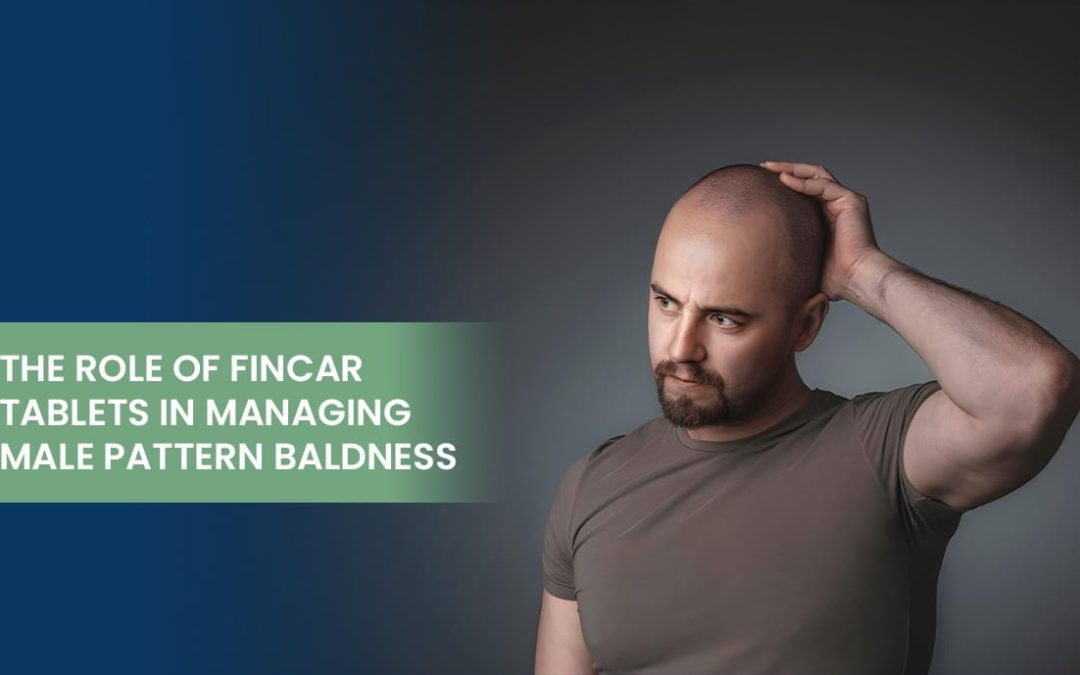 The Role of Fincar Tablets in Managing Male Pattern Baldness