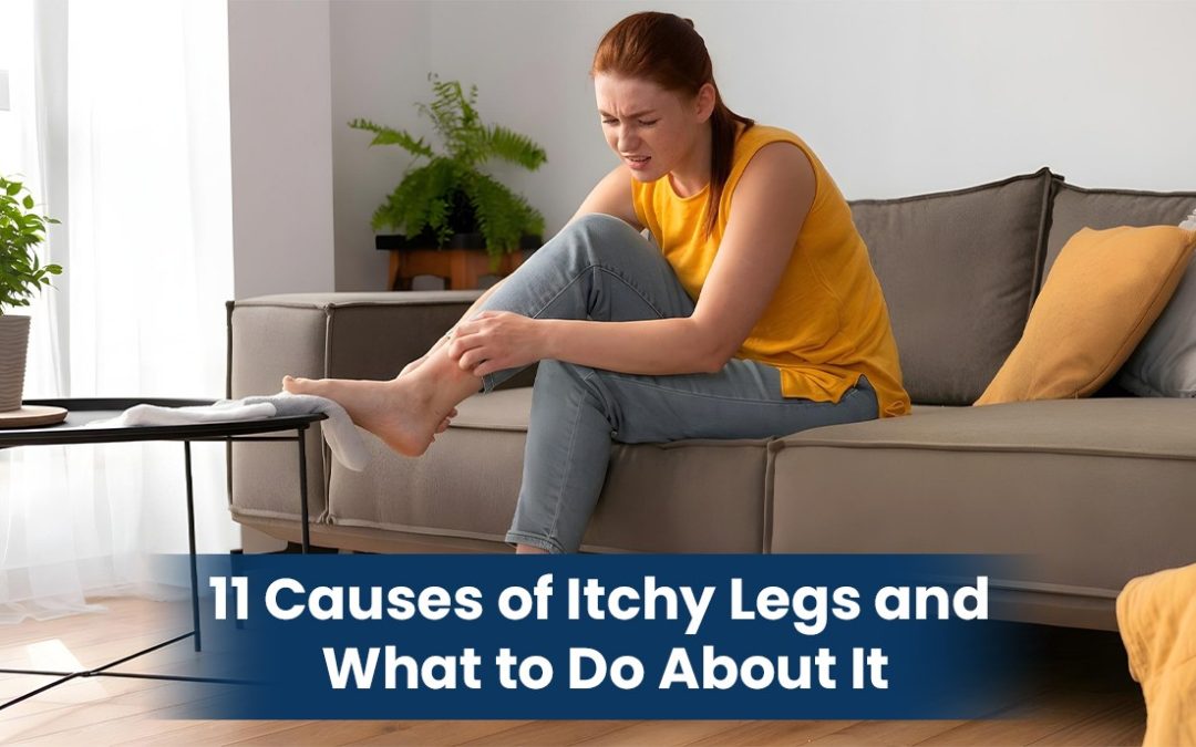 11 Causes of Itchy Legs and What to Do About It