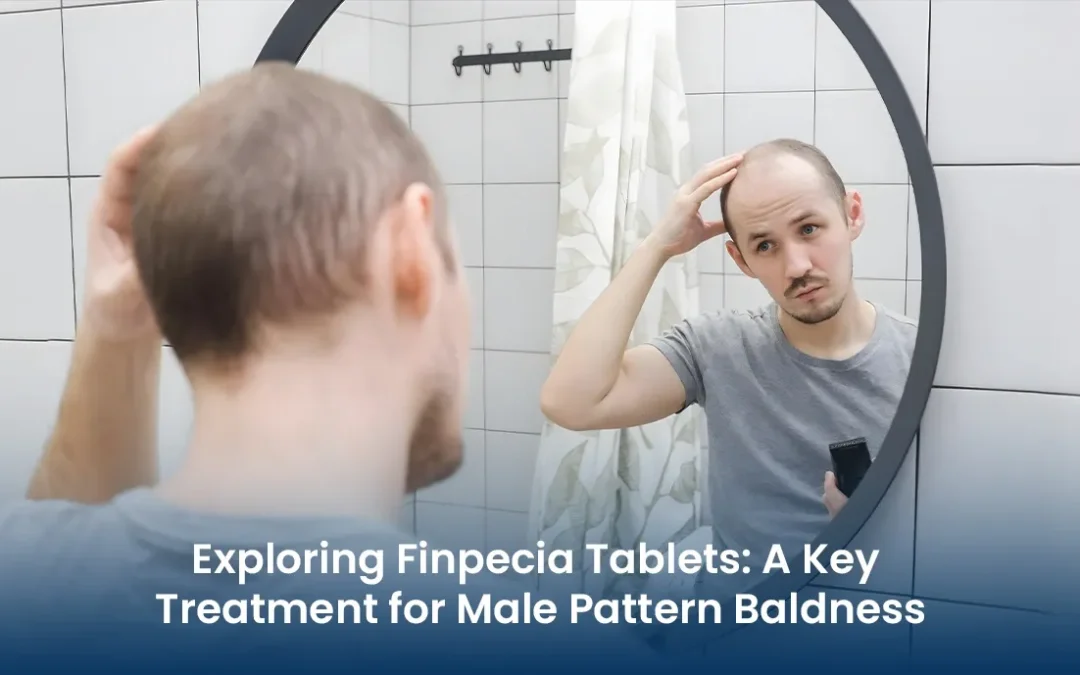 Exploring Finpecia Tablets: A Key Treatment for Male Pattern Baldness