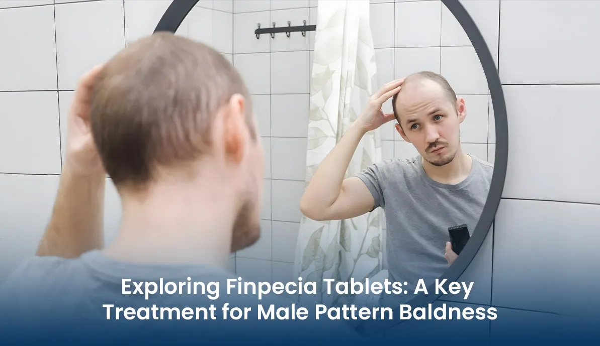 Exploring Finpecia Tablets: A Key Treatment for Male Pattern Baldness