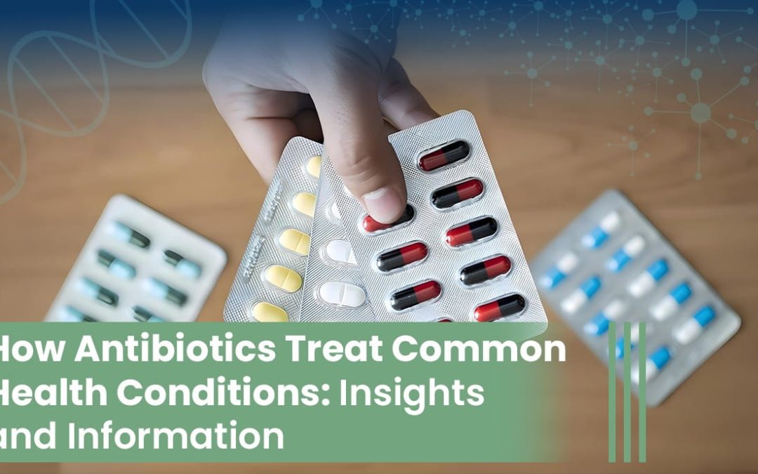 How Antibiotics Treat Common Health Conditions: Insights and Information