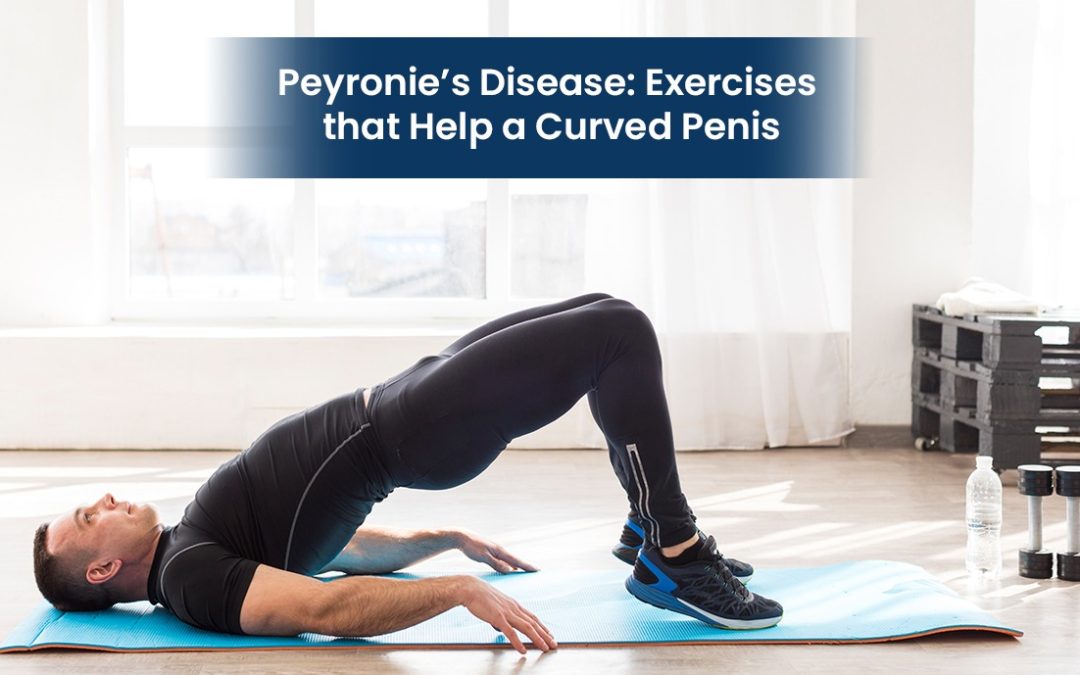 Peyronie’s Disease: Exercises that Help a Curved Penis