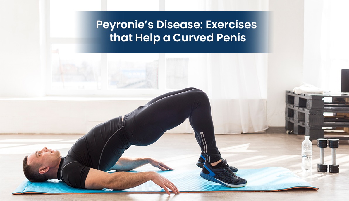 Peyronie’s Disease: Exercises that Help a Curved Penis